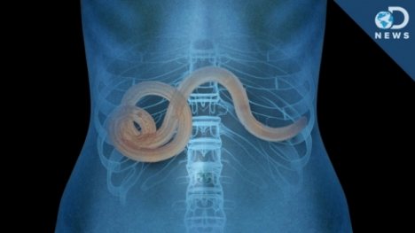 Cum un parazit intestinal iti poate schimba viata